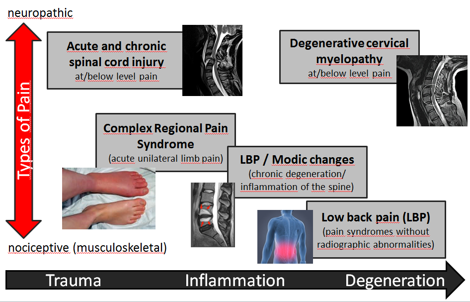 pain disorders