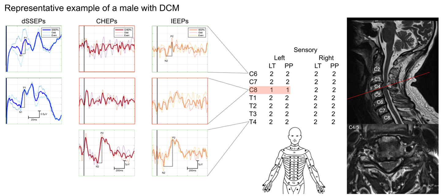 Grafik Neurophys