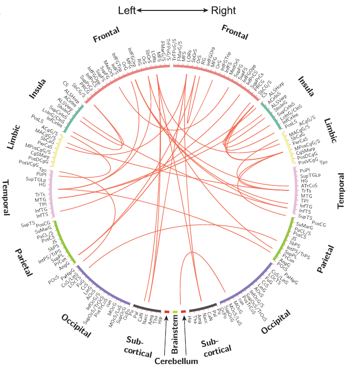 functional brain connectivity